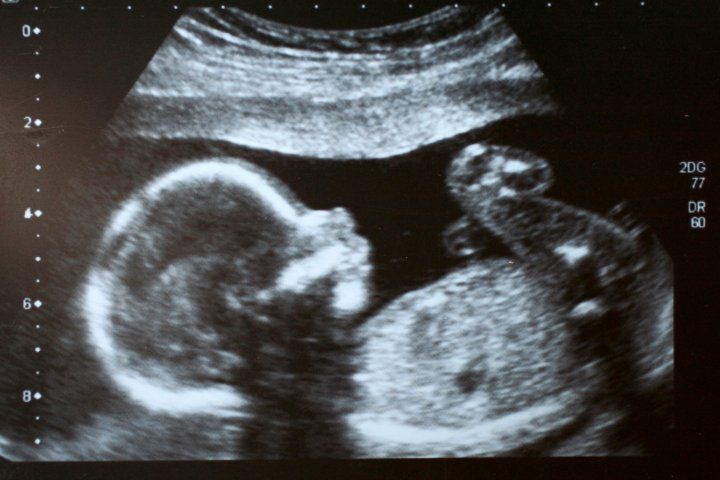 یافته های جدید پژوهشگران دانشگاه هاروارد در مورد دوران بارداری