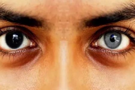 جذابیت یا درد و پشیمانی؟ خطرات جراحی تغییر رنگ چشم