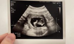 غربالگری‌های غیرعلمی باعث سقط هزاران جنین سالم شد