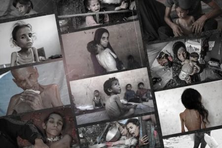 افزایش نوزادان مبتلا به ناهنجاری‌های مادرزادی در غزه؛ پیامد تلخ جنگ و کمبود دارو